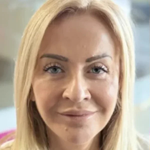 Prije: Danijela A., cijelo lice