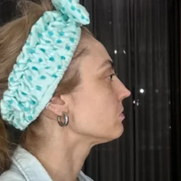 Prije: Michelle M., profil
