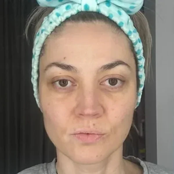 Prije: Michelle M., sprijeda