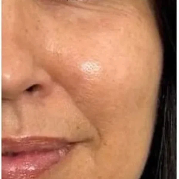 Nakon 1 mjeseca (REMS REVIVE): Korisnica, 52, izbliza